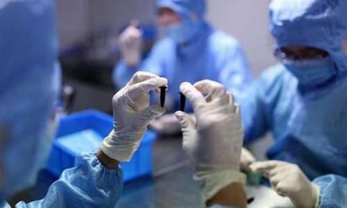 【独家】从IVD试验员到项目经理：（44）我看临床试验研究