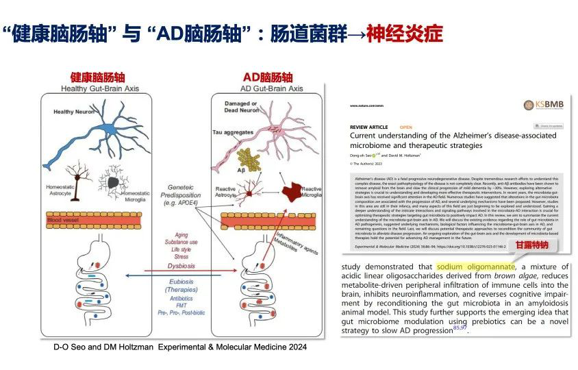 治疗阿尔茨海默病国产新药断货与思考